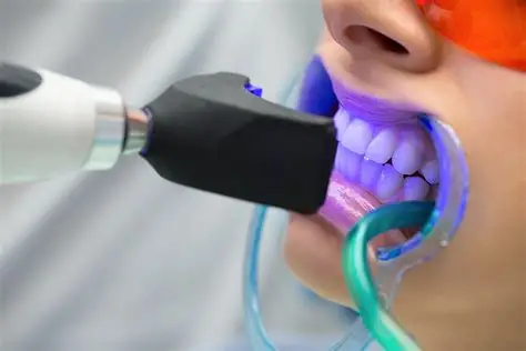 Teeth Whitening Overview